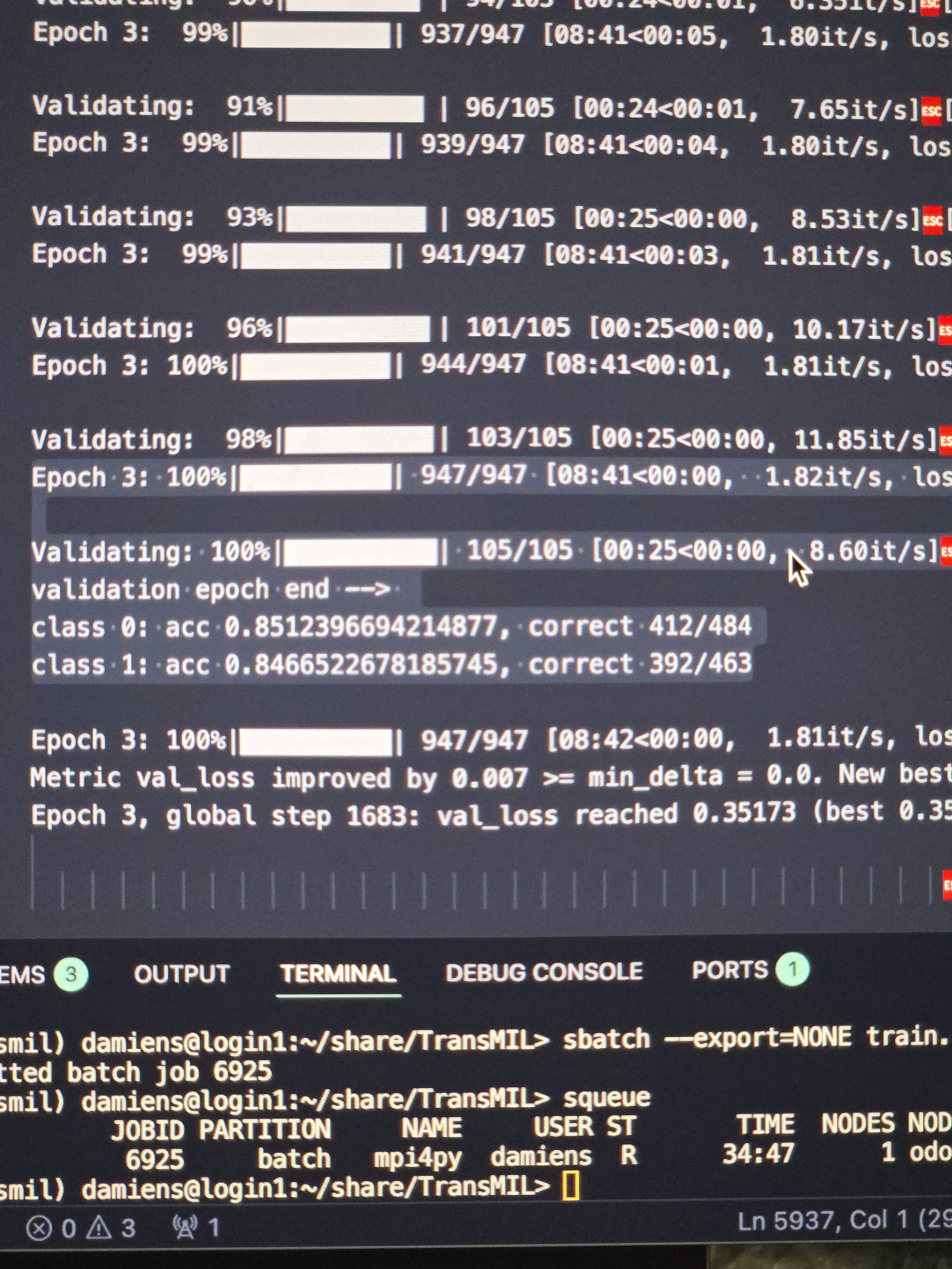 Terminal output showing model validation progress during a TransMIL training run